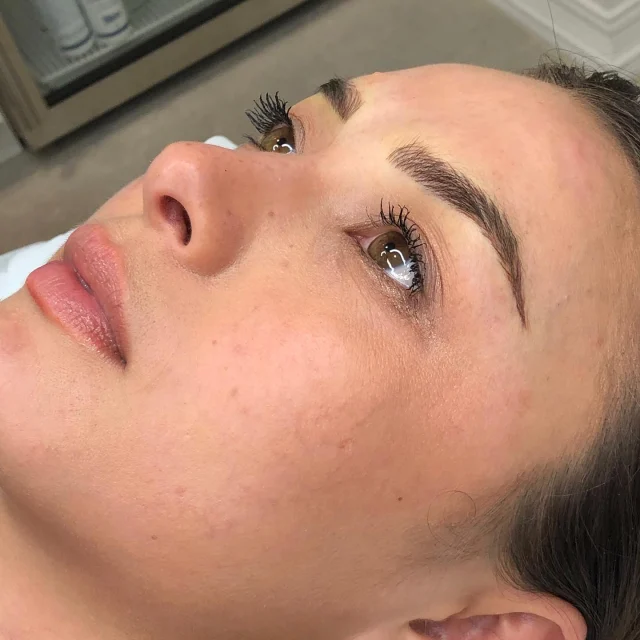 Brow tattoo result shared by La Klinic